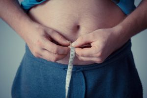 DISPELLING THE MYTHS ABOUT LIPEDEMA AND OBESITY