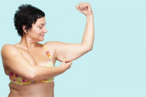 Arm Yourself Against Upper Body Lipedema Difficulties